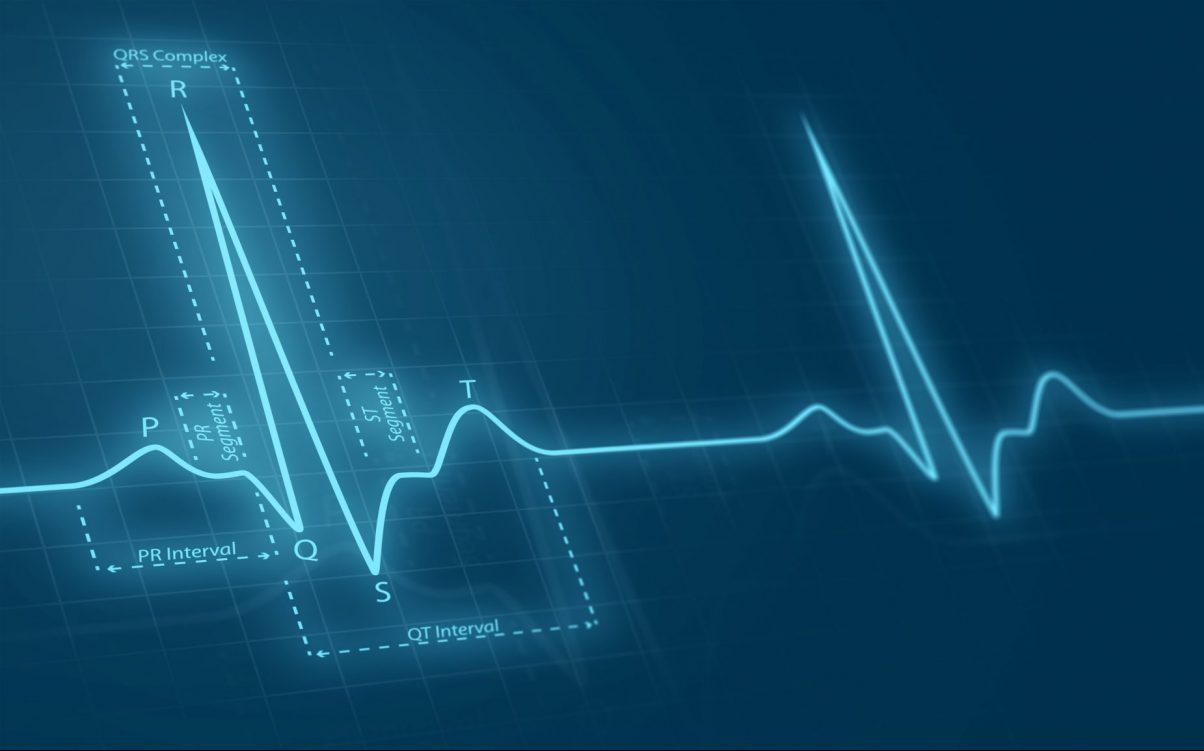 ekg
